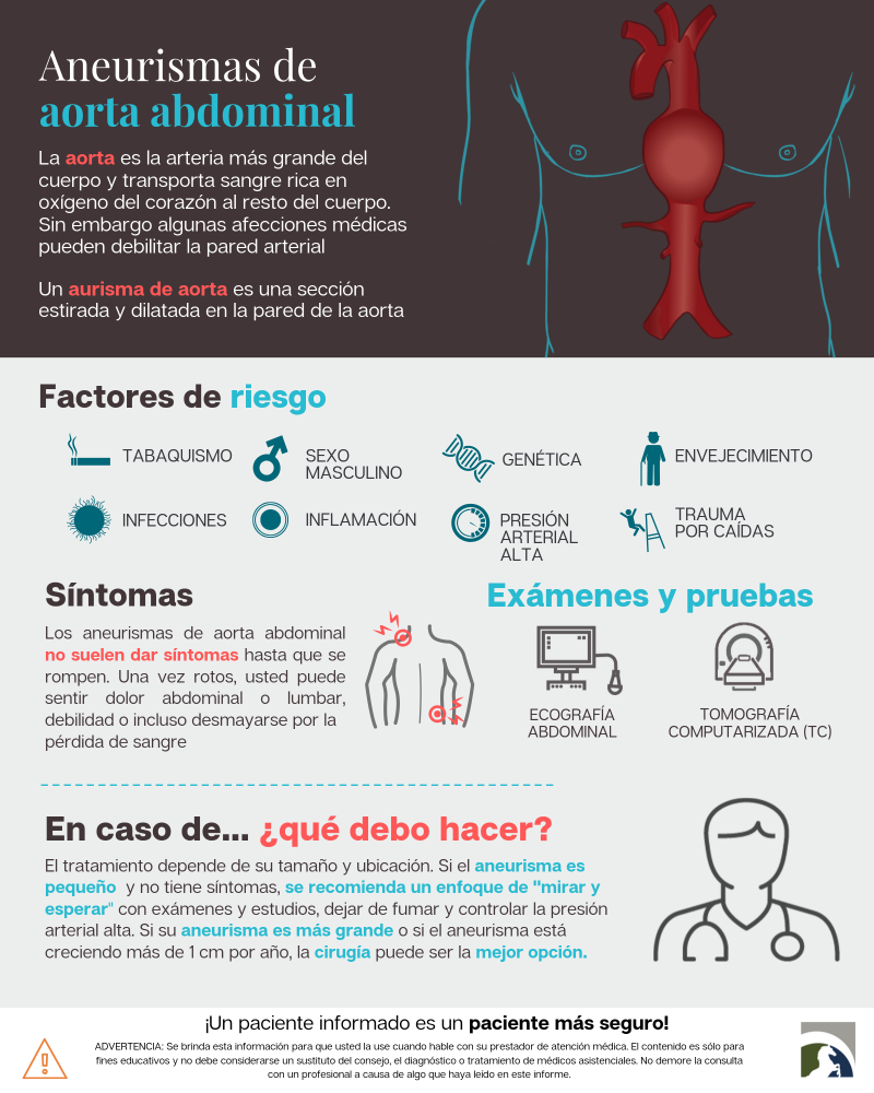 Aneurisma Aórtico Abdominal: Qué Es Y Cuál Es Su Tratamiento – DCGILG